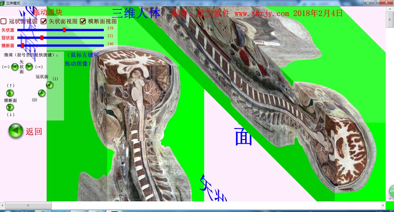 三维人体(数字人体标本)